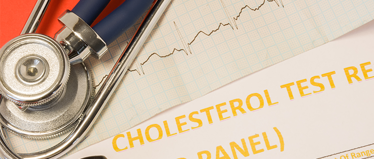 Tips for Your Cholesterol