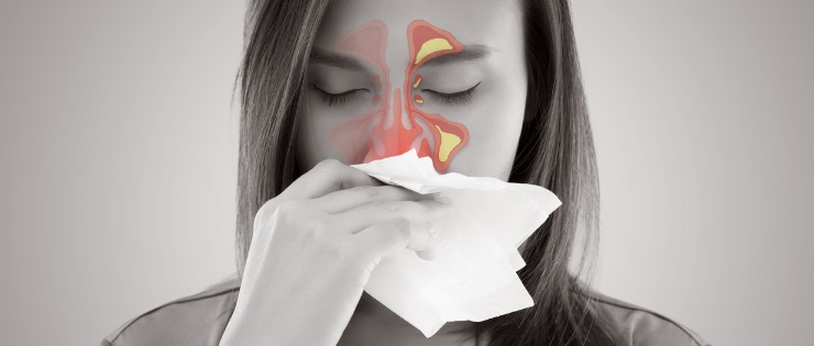an image showing rhinitis (inflammation of the nasal cavity) both the cold and hay fever cause rhinitis