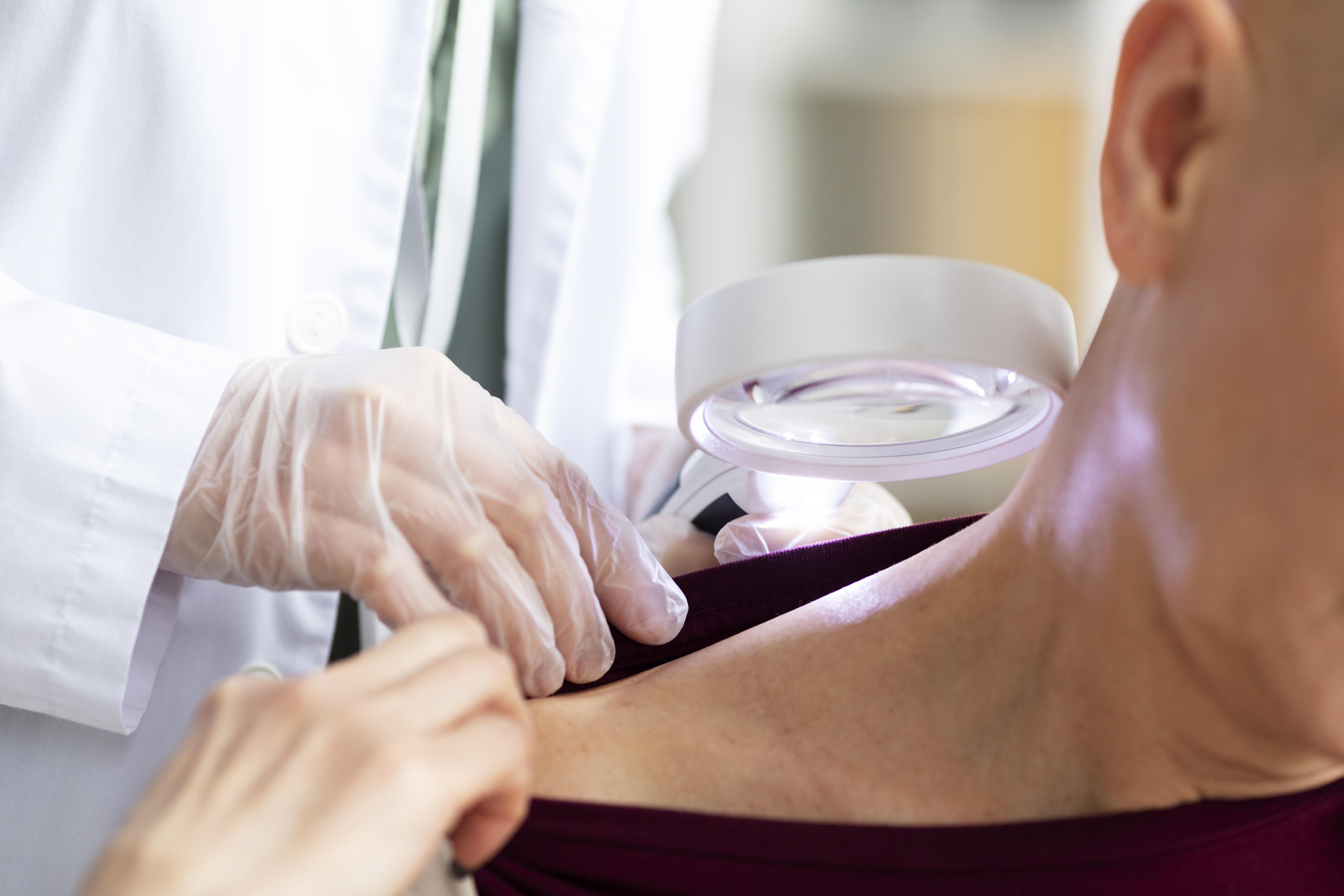 Close up image of doctor conducting skin health check