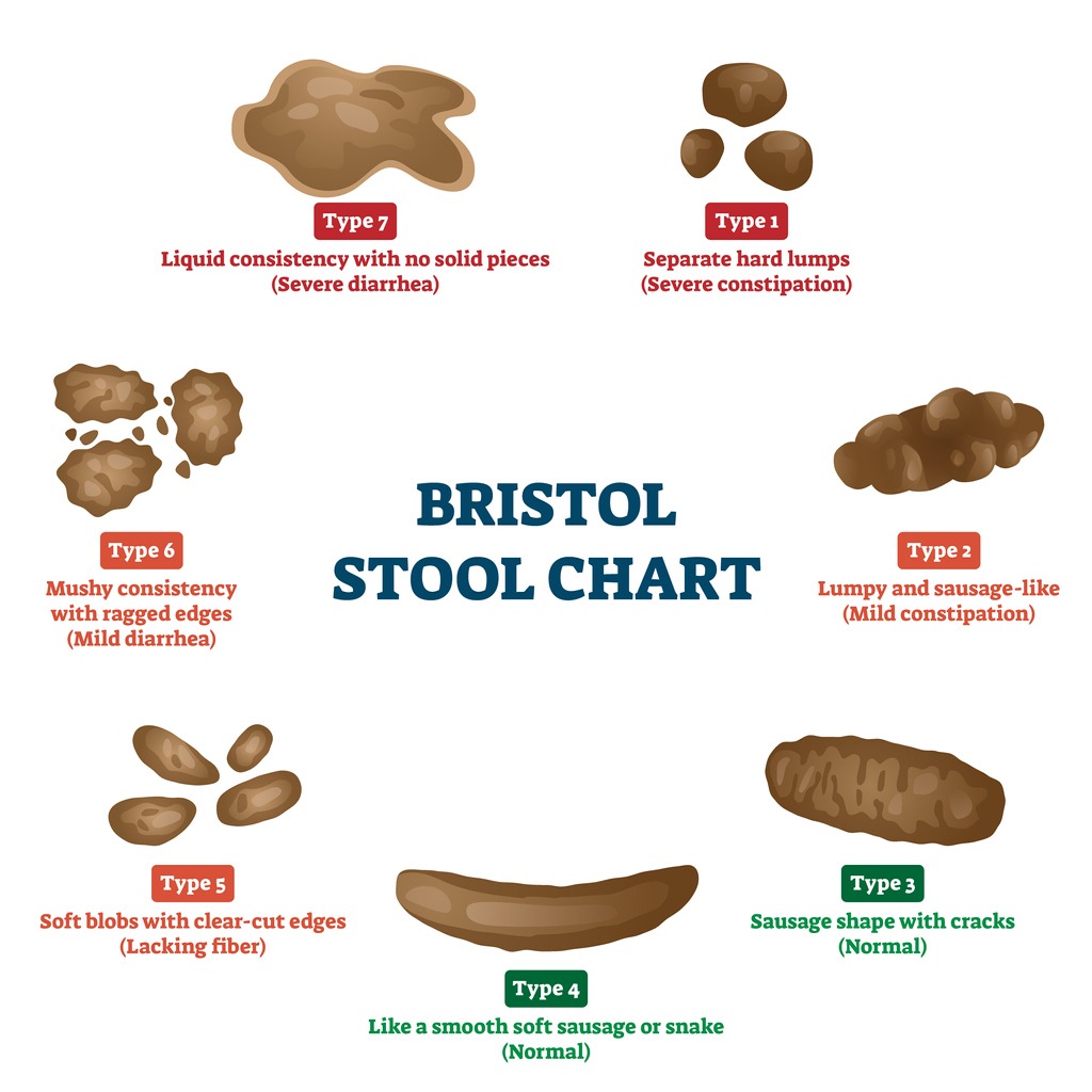 The Bristol Stool chart showing what a healthy poop should look like 