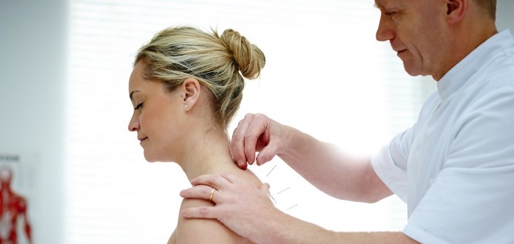 Physiotherapist doing acupuncture on the back of a female patient 
