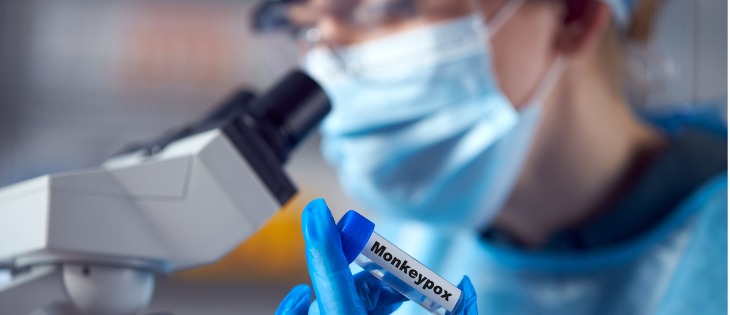 Monkeypox Virus Symptoms and Transmission - Debunking the Myths